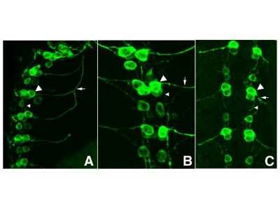 Immunohistochemical Staining of Drosophila Central Nervous System Tissue Using Biotin Conjugated GFP Antibody
